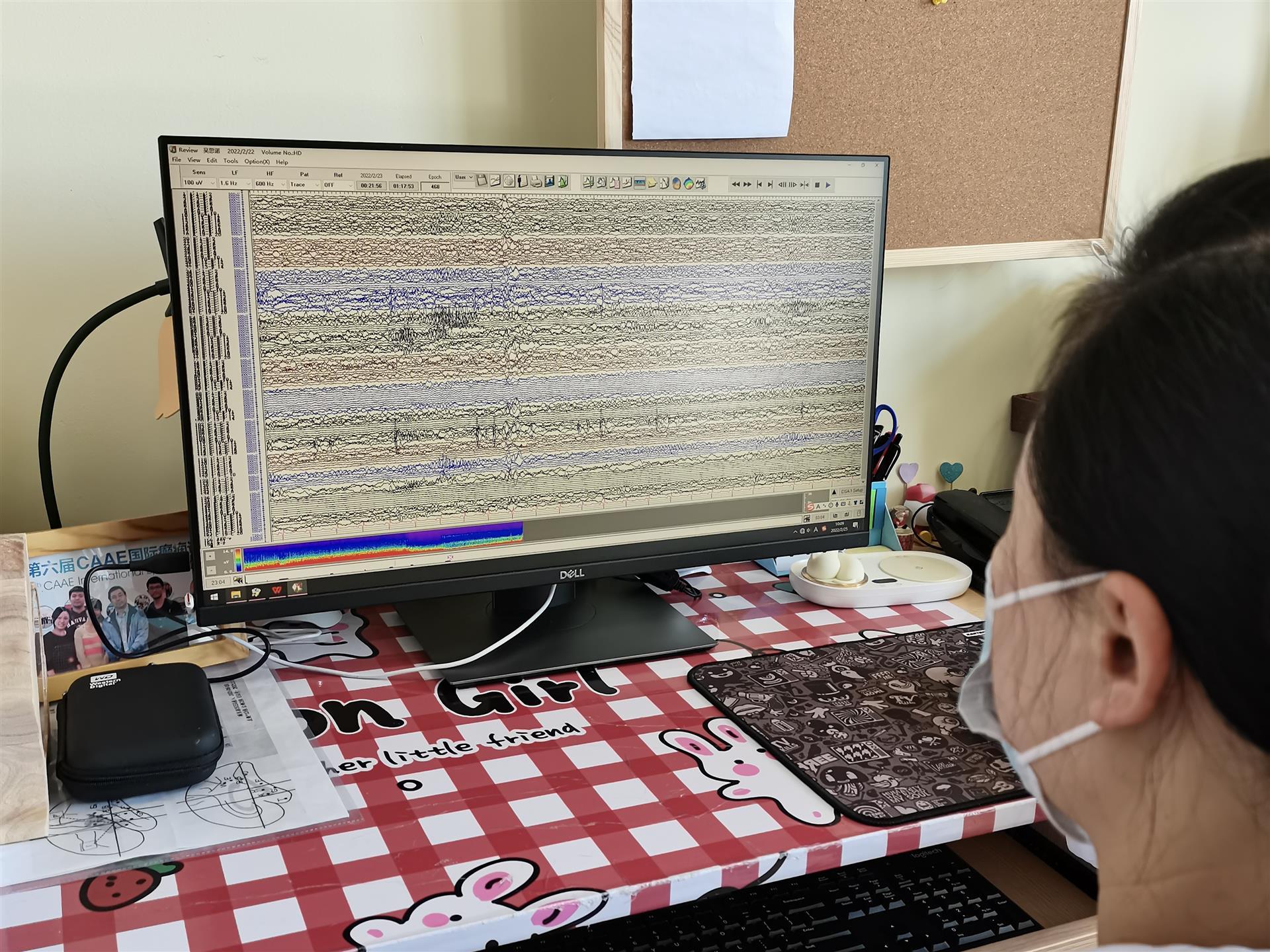 脑接口技术，开启未来医疗与科技的突破性解决办法